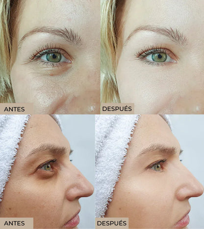 Celyn™ Reafirmante Facial Instantáneo