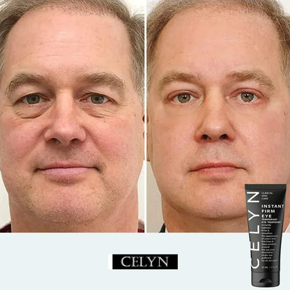 Celyn™ Reafirmante Facial Instantáneo