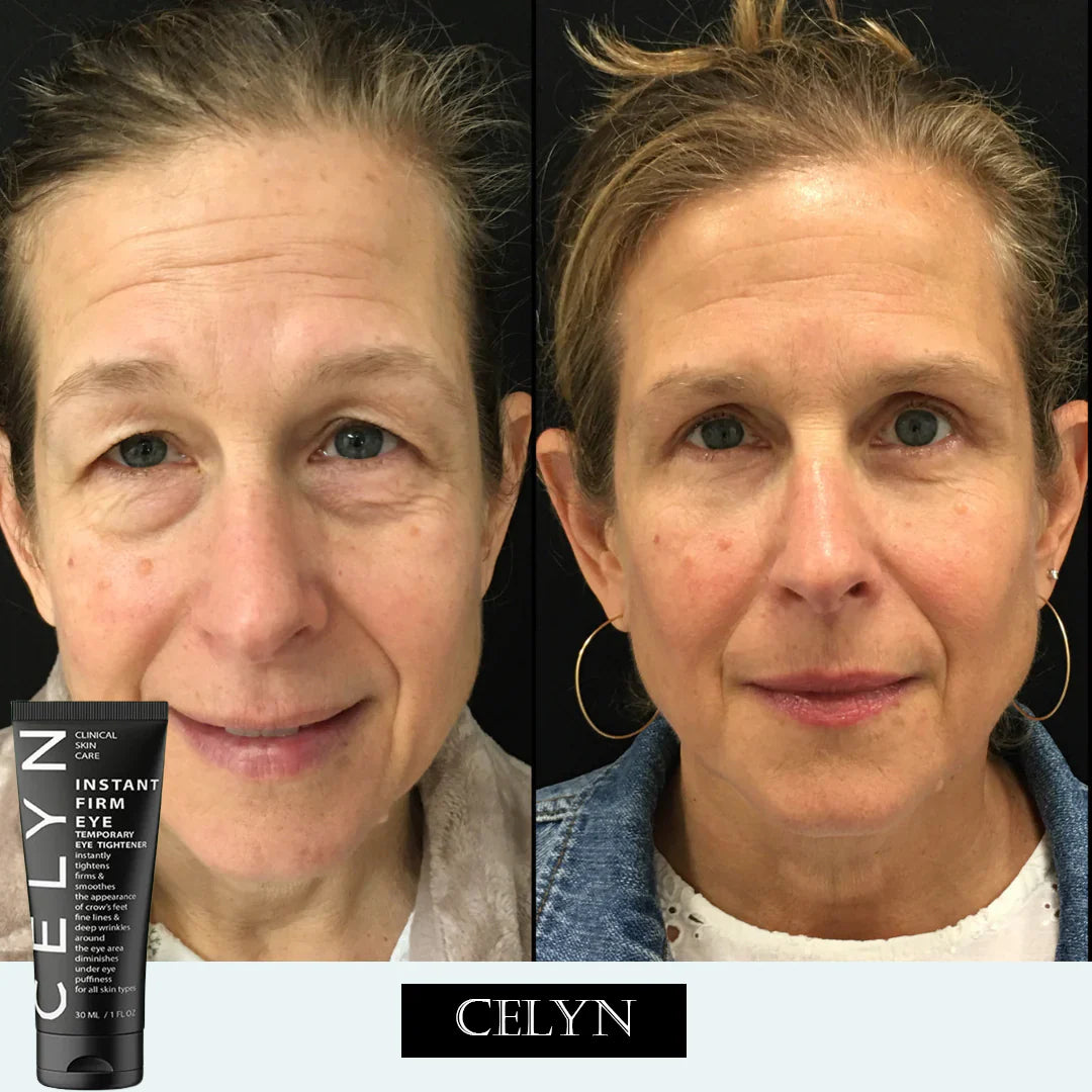 Celyn™ Reafirmante Facial Instantáneo