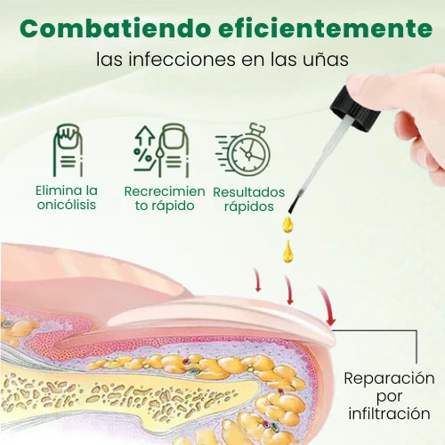 Biancat™ - Serum de crecimiento y reparación de uñas en 7 días