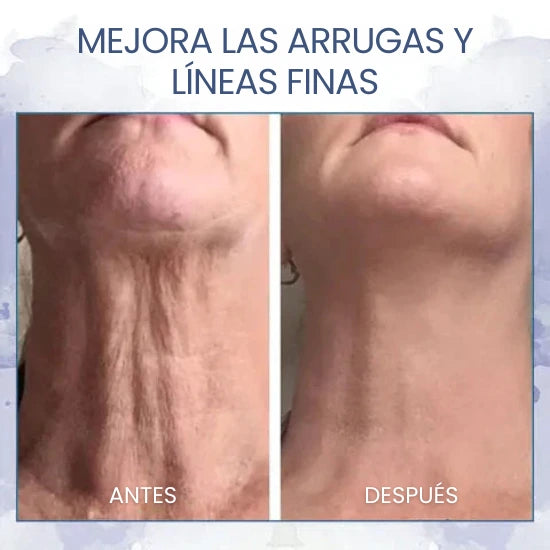 𝗝𝗘𝗥𝗘𝗠𝗬𝗧𝗜𝗦™ Crema avanzada reafirmante y reductora de arrugas: Restaura la elasticidad de la piel