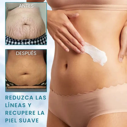 𝗝𝗘𝗥𝗘𝗠𝗬𝗧𝗜𝗦™ Crema avanzada reafirmante y reductora de arrugas: Restaura la elasticidad de la piel