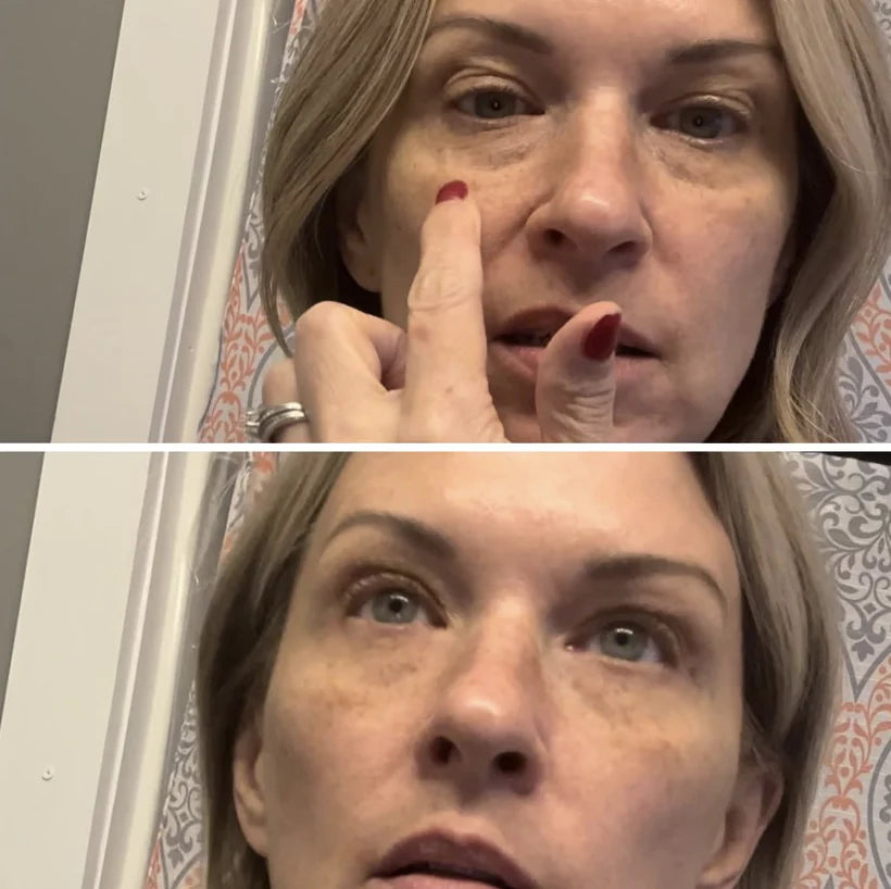 Celyn™ Reafirmante Facial Instantáneo
