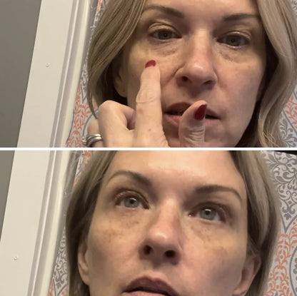 Celyn™ Reafirmante Facial Instantáneo