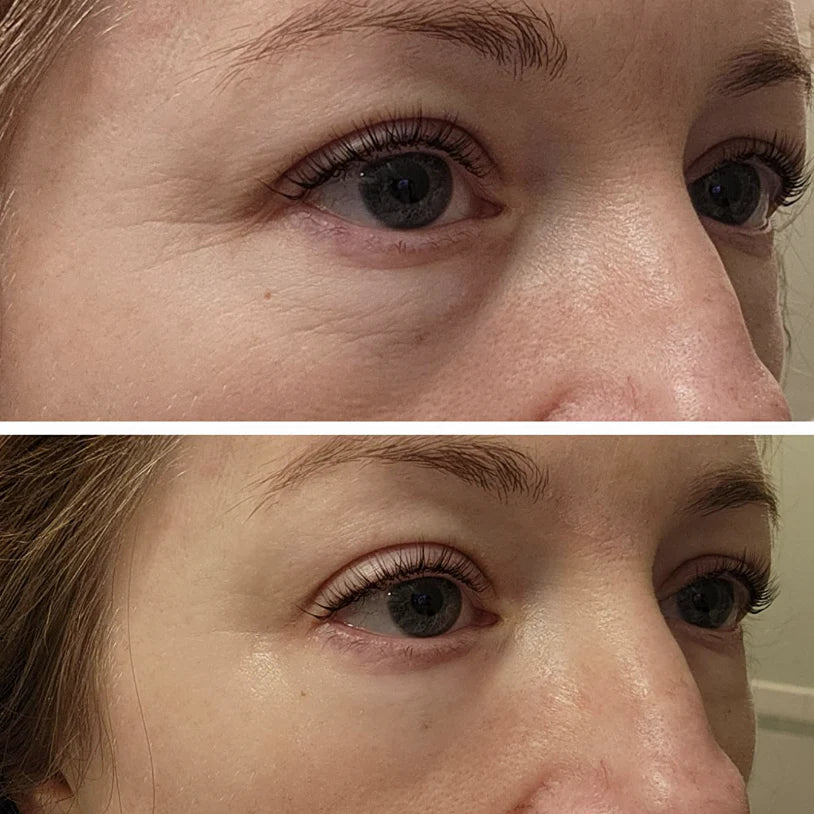 Celyn™ Reafirmante Facial Instantáneo