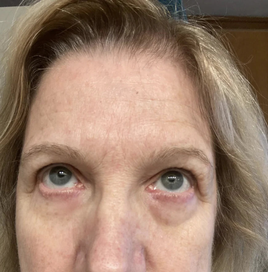 Celyn™ Reafirmante Facial Instantáneo