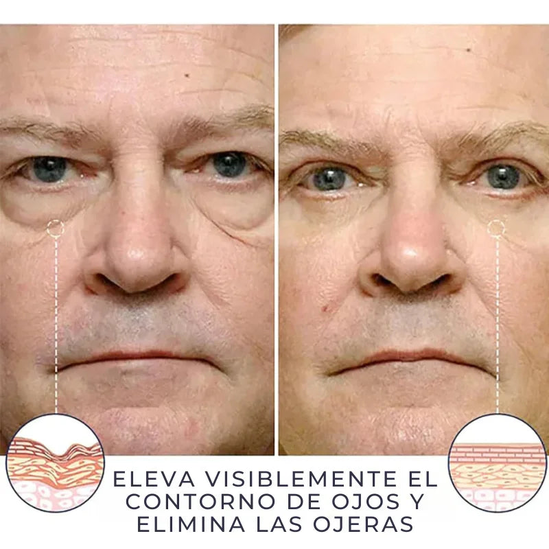 Celyn™ Reafirmante Facial Instantáneo